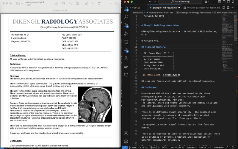 #GitHub #OCR #API📁 pdf-extract-api - 高精度文档解析和提取 API▎项目功能